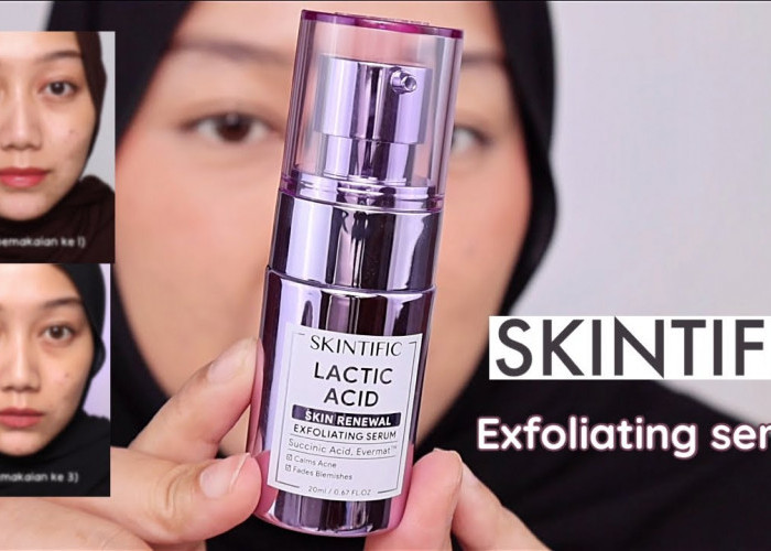 Review Jujur Serum Eksfoliasi Skintific Varian Lactic Acid, Ampuh Angkat Sel Kulit Mati dan Bikin Glowing 