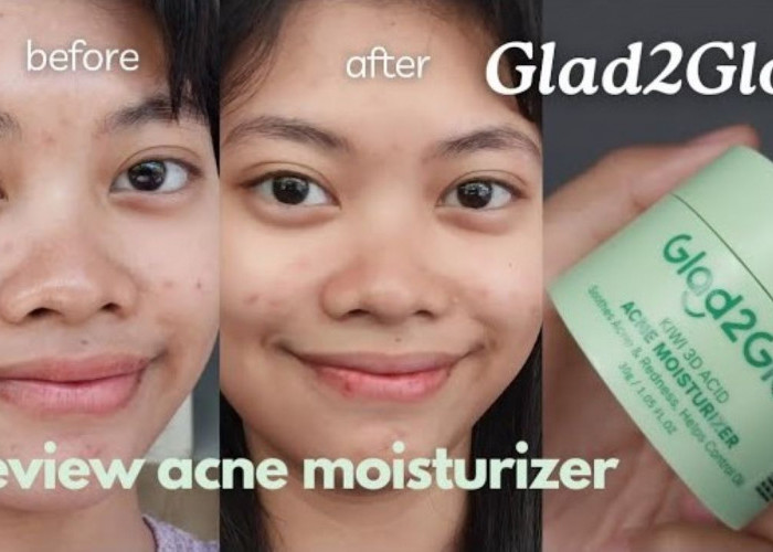 Review Battle Moisturizer Glad2Glow Pink vs Moisturizer Glad2Glow Hijau, Mana yang Terbaik? 