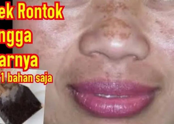 Racikan Teh untuk Mengelupas Flek Hitam, Begini Cara Membuatnya Agar Penuaan Dini