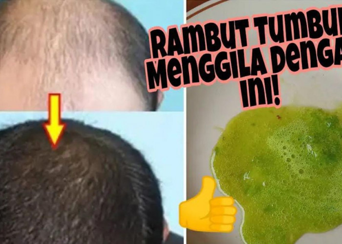 Cara Cepat Menumbuhkan Rambut Pakai Bahan Alami, Bagus untuk Menghilangkan Uban Agar Hitam Permanen