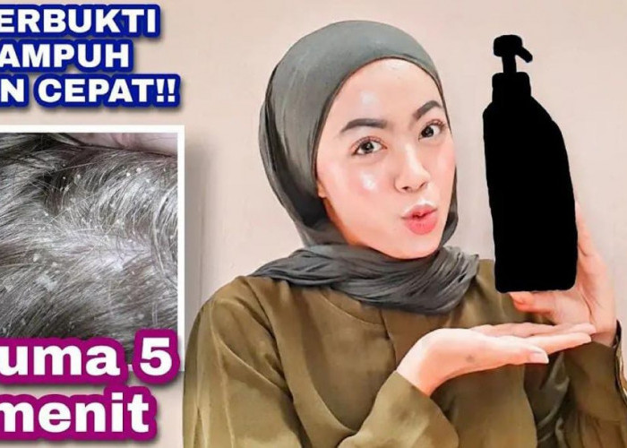 3 Rekomendasi Shampo untuk Kulit Kepala Kering dan Rusak! Cuma 20 Ribu Bikin Rambut Sehat