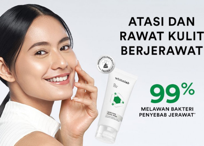 5 Rekomendasi Produk Whitelab untuk Menghilangkan Jerawat, Bikin Mulus sampai Bekasnya!