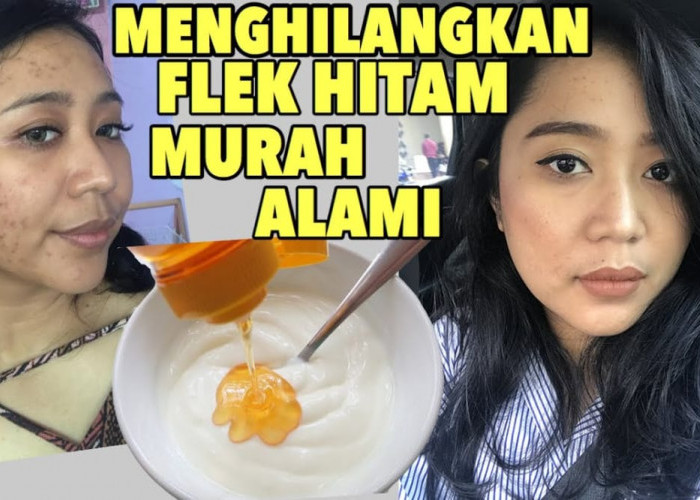 Begini Cara Pakai Masker Minyak Zaitun dan Madu untuk Menghilangkan Flek Hitam, Cuma 2 Bahan Wajah Jadi Glowin