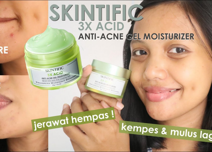 Review Moisturizer Skintific 3X Acid untuk Kulit Berjerawat dan Bruntusan