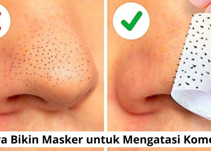 Cara Bikin Masker untuk Mengatasi Komedo dengan 2 Bahan Dapur, Bikin Wajah Jadi Mulus