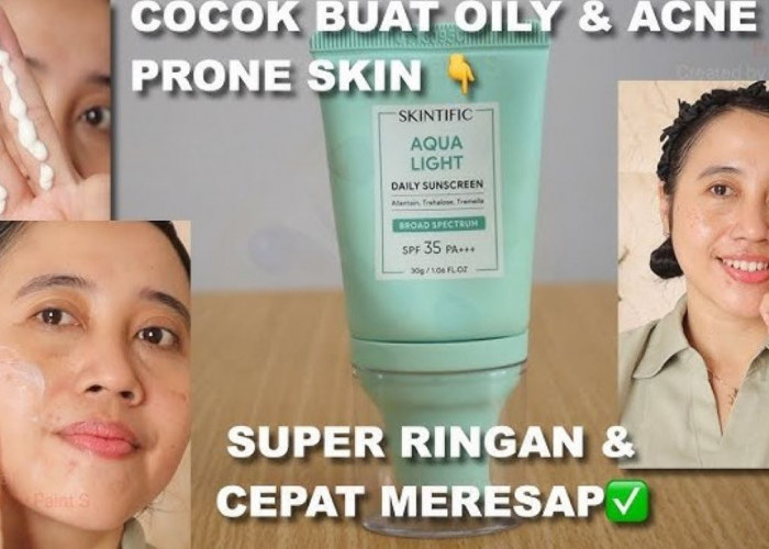 6 Merk Sunscreen untuk Oily Acne Prone Skin, Nggak Bikin Jerawatan dan Kusam