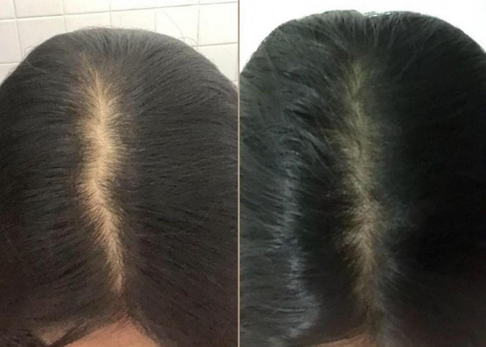 3 Cara Cepat Menghitamkan Rambut Uban Permanen Dengan Bahan Alami Bikin Rambut Hitam Permanen Tampil Awet Muda