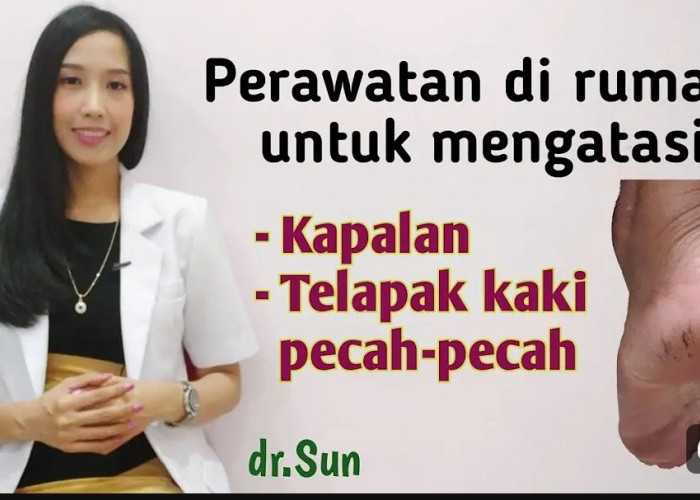 Inilah Sederet Cara Ampuh Hilangkan Pecah-pecah di Kaki Secara Sederhana