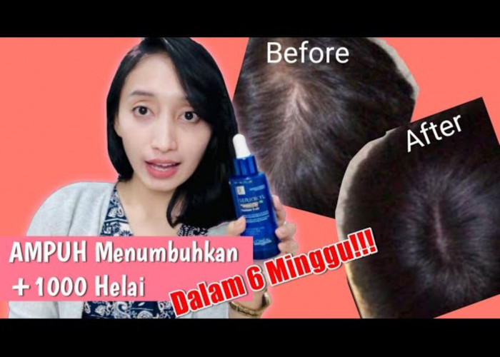 Rekomendasi Serum Penumbuh Rambut Tercepat! Rambut jadi Hitam dan Kuat Berkilau