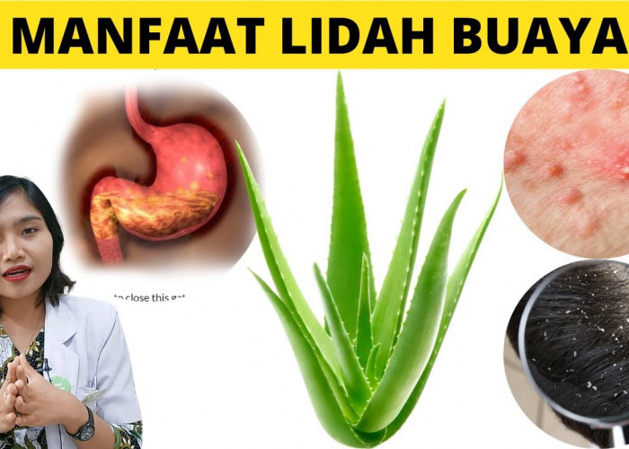 Ini 2 Manfaat Lidah Buaya yang Baik Untuk Kesehatan, Apa Saja?