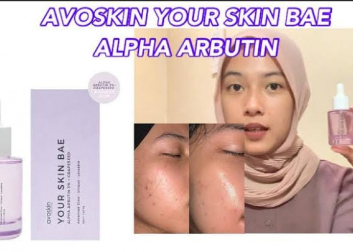 5 Skincare yang Cepat Menghilangkan Flek Hitam, Hasilnya Kulit Auto Glowing dan Awet Muda Sepanjang Masa