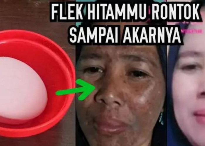 4 Sabun Wajah Batangan Pengelupas Flek Hitam yang Menahun, Ampuh Kecilkan Pori-Pori