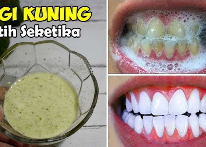 3 Bahan Alami yang Bagus untuk Menghilangkan Gigi Kuning, Bikin Bau Mulut Hilang dan Gigi Putih Permanen