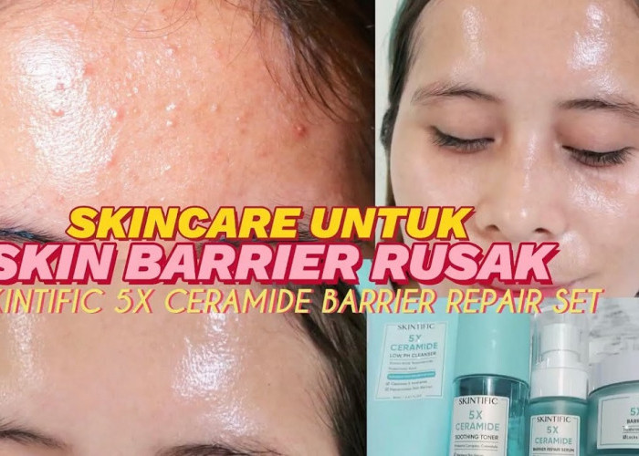 Review Skintific 5X Ceramide Barrier Moisturizer Gel, Benarkah Bisa Melembapkan Kulit Wajah yang Kering Kusam?