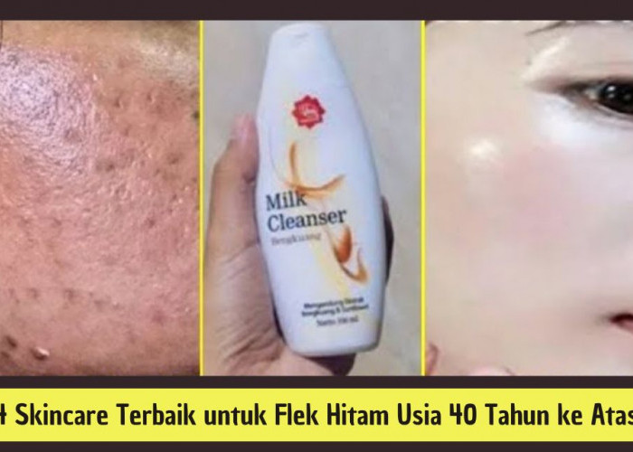 4 Skincare Terbaik untuk Flek Hitam Usia 40 Tahun ke Atas, Minimalkan Tanda Penuaan Bikin Glowing!