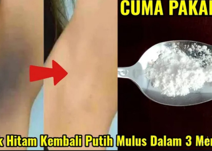 4 Bahan Pemutih Ketiak Alami yang Ampuh untuk Menghilangkan Bau Badan, Ketiak Hitam jadi Putih Permanen