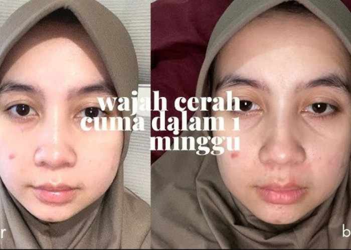 Cara Menjaga Kulit Agar Tetap Cerah Selama Bulan Puasa, Cukup Manfaatkan 3 Bahan Alami Ini