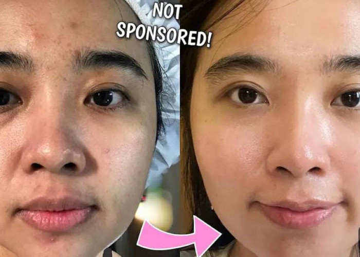 3 Cara Membuat Masker Minyak Zaitun untuk Membuat Wajah Glowing Bebas Flek Hitam, Bantu Kecilkan Pori-Pori