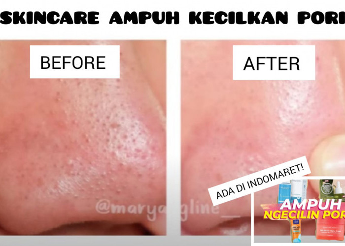 4 Rangkaian Skincare Efektif Kecilkan Pori-Pori Bikin Flawless, Harga di Bawah 50 Ribu Tersedia di Indomaret!