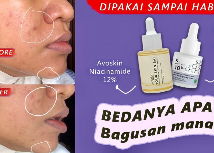 Serum Niacinamide Avoskin vs Somethinc! Battle Mana yang Paling Bagus dan Ampuh Cerahkan Wajah?