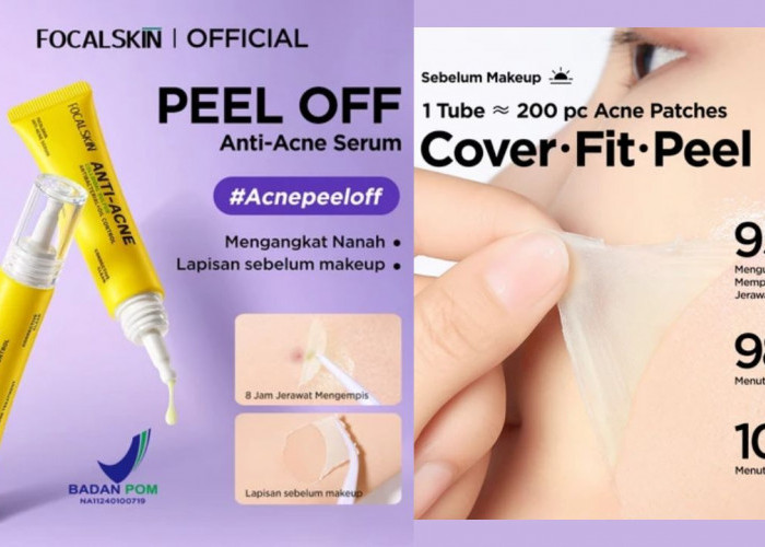 Review Focalskin Anti-Acne Serum Peel Off, 8 Jam Jerawat Langsung Kempis