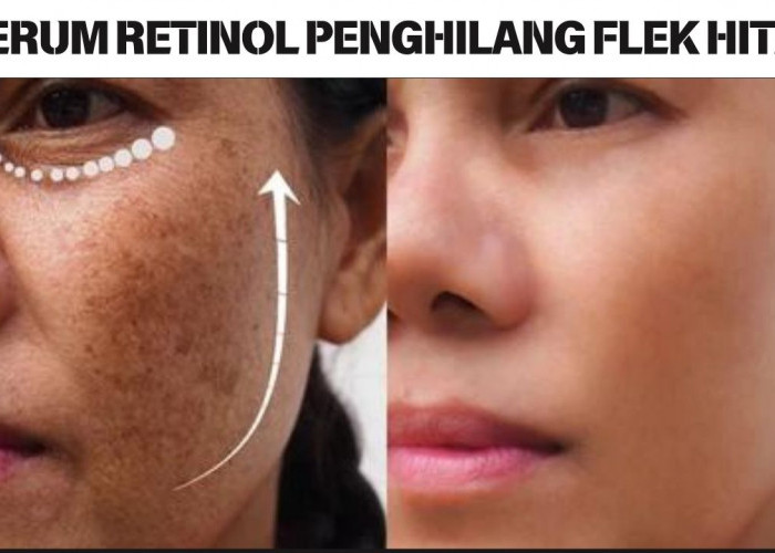 4 Serum Retinol Penghilang Flek Hitam Usia 40 Tahun Ke Atas, Pudarkan Kerutan Bikin Wajah Kencang Awet Muda!