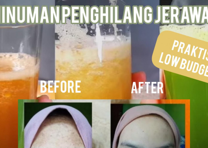 DIY Minuman Penghilang Jerawat Praktis Bisa Buat Detox Juga, Wajah Cantik Mulus Alami Sudah Terbukti Ampuh!