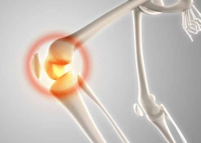 Ampuh Mengatasi Tulang Linu Lansia, Ini Dia Vitamin D Terbaik untuk Mencegah Osteoporosis