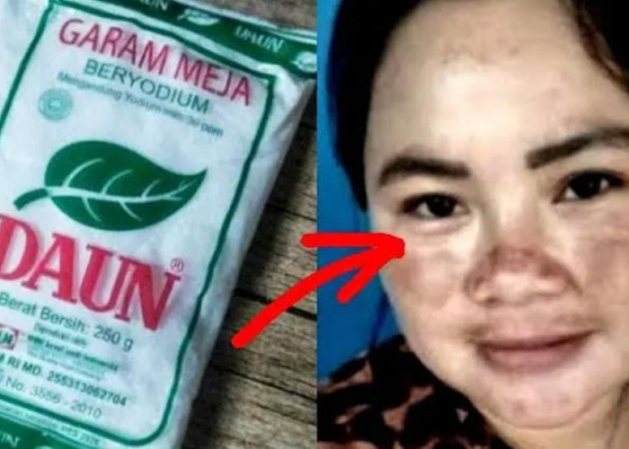 Diy Garam Pengelupas Flek Hitam Dalam 1 Malam, Begini 3 Cara Raciknya Agar Wajah Glowing dan Mulus