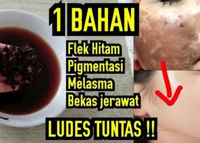 2 Bahan Dapur untuk Menghilangkan Flek Hitam yang Membandel, Kulit Jadi Glowing!