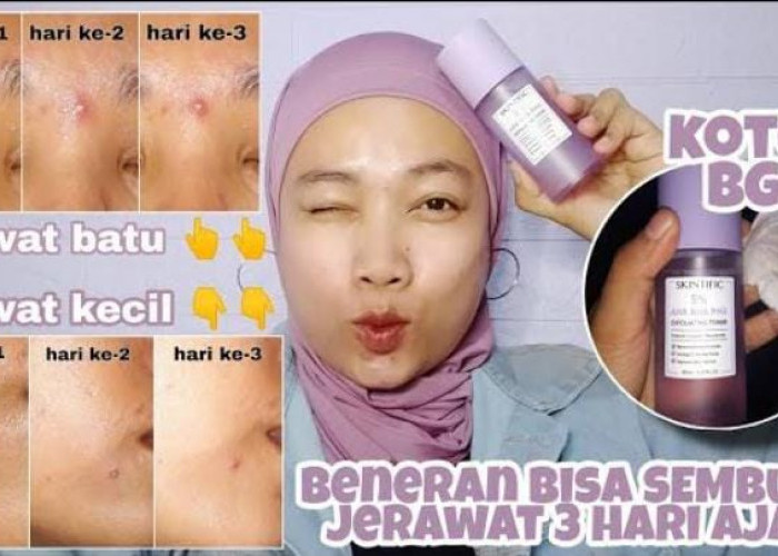 4 Toner Eksfoliasi yang Bisa Mencerahkan Wajah, Kecilkan Pori-Pori Kulit Jadi Mulus dan Glowing