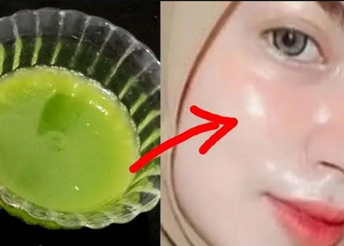 DIY Masker Lidah Buaya Pengelupas Flek Hitam Dalam 1 Malam, Begini 3 Cara Meraciknya