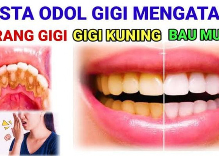 4 Produk Pasta Gigi Paling Ampuh Merontokkan Karang Gigi Membandel dalam 1 Malam, Bikin Putih Tanpa Plak