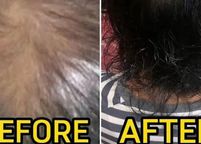 4 Bahan Alami untuk Menghilangkan Rambut Uban Permanen, Ternyata Ini Cara Pakai yang Benar