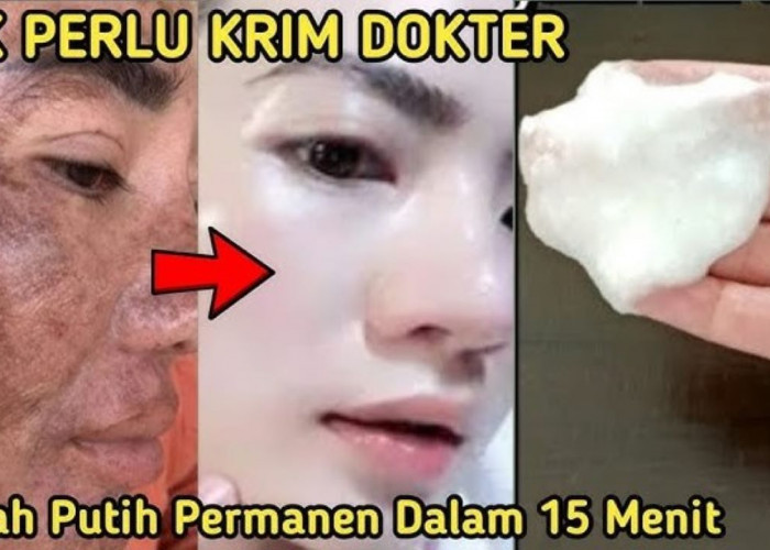 DIY Racikan Susu Pengelupas Flek Hitam dalam 1 Malam, Begini Cara Membuatnya