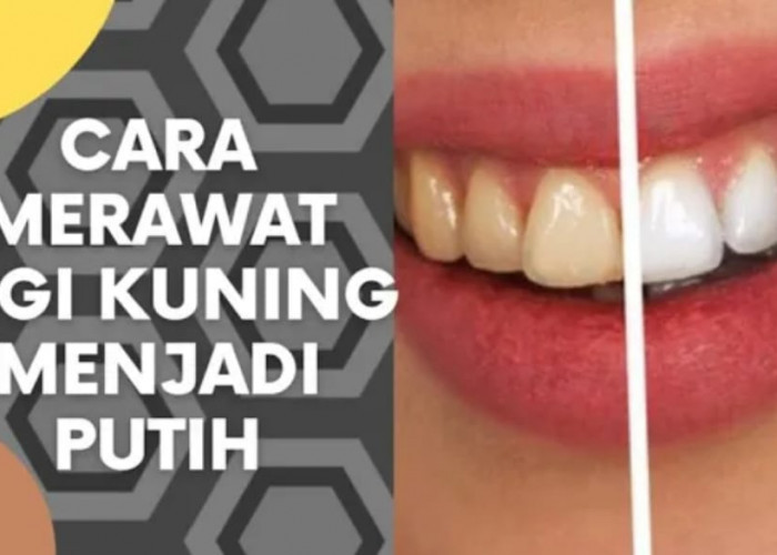 Inilah 4 Cara Memutihkan Gigi Kuning yang Membandel Secara Alami, Gigi Putih Permanen dan Bebas Bau Mulut
