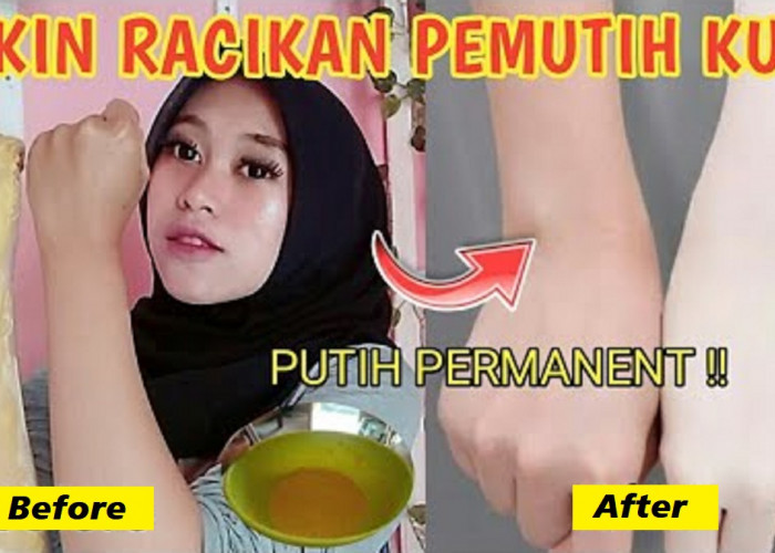 Begini Cara Membuat Kulit Putih Permanen dalam 1 Hari, Efektif Cerahkan Kulit Gak Perlu Skincare Bisa Glowing