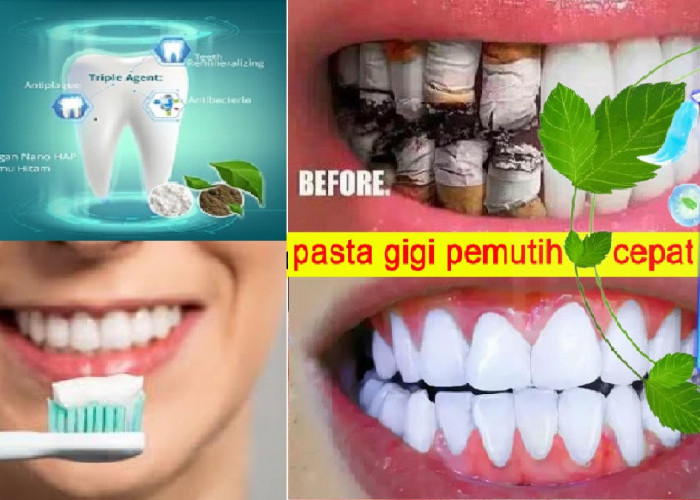 6 Rekomendasi Merek Pasta Gigi yang Ampuh Hilangkan Karang Gigi yang Membandel, Efektif Putihkan Gigi No Plak