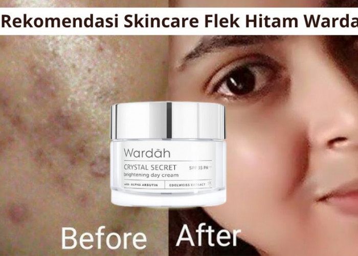 5 Rekomendasi Skincare Flek Hitam Wardah, Bikin Wajah Glowing dan Cerah Merata Rahasia Tampil Awet Muda