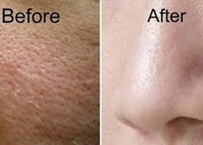 3 Skincare Pengecil Pori-Pori untuk Wajah Glowing, Cocok Dipakai Usia 40 Tahun Ke Atas Agar Awet Muda