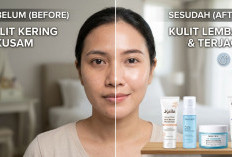 4 Rekomendasi Moisturizer Melembabkan dan Menjaga Skin Barrier, Cocok untuk Kulit Kering Kusam