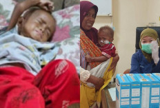 RSUD Batang Kawal 40 Anak dengan Masalah Gizi, Salah Satunya Naik dari 6,1 Kg Jadi 11 Kg