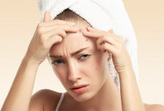 5 Penyebab Jerawat Selalu Muncul di Wajah Walaupun Rutin Pakai Skincare 