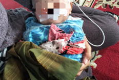 Bayi 7 Bulan di Wiradesa Berjuang Lawan Bibir Sumbing, Orang Tua Harapkan Bantuan Pengobatan