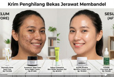 5 Merk Krim Penghilang Bekas Jerawat Membandel di Wajah, Bikin Cerah!