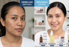 Top 4 Skincare Flek Hitam Terbaik yang Bisa Dipakai Secara Rutin Agar Kulit Glowing