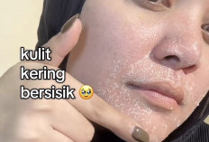 Wajah Kering Saat Puasa Ramadan?Ini 5  Cara Menjaga Kelembapan Kulit Sepanjang Hari