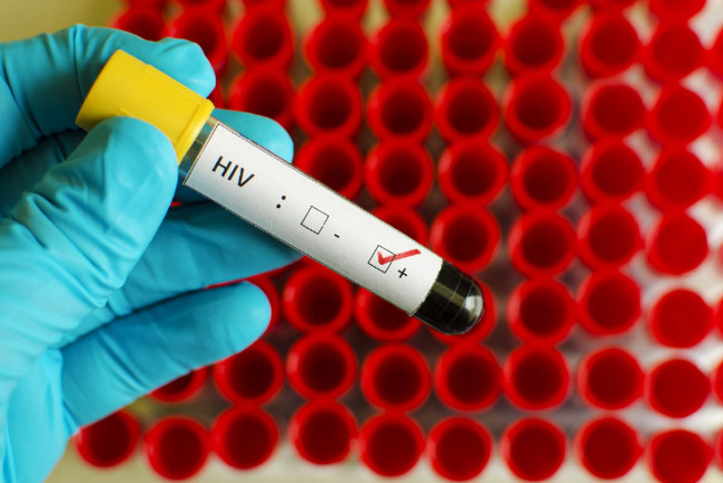 6 Bulan Ada 31 Kasus HIV/AIDS di Kabupaten Pekalongan, Tersebar di 12 Kecamatan